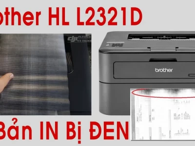 Máy in Brother Bị Đen Bản In Sau Khi Thay Hộp Mực Nguyên Nhân và Cách Khắc Phục